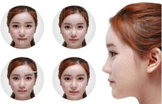 韩式隆鼻一般多少钱一次，韩式隆鼻一般多少钱一颗