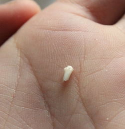 女人梦见牙齿松动一拔就掉了，梦到牙齿松动然后用手拔掉了
