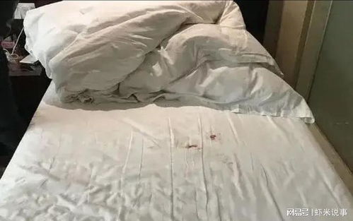如家酒店床单弄上血赔多少，酒店床单弄上血赔多少钱 自己洗了他还要收折损费