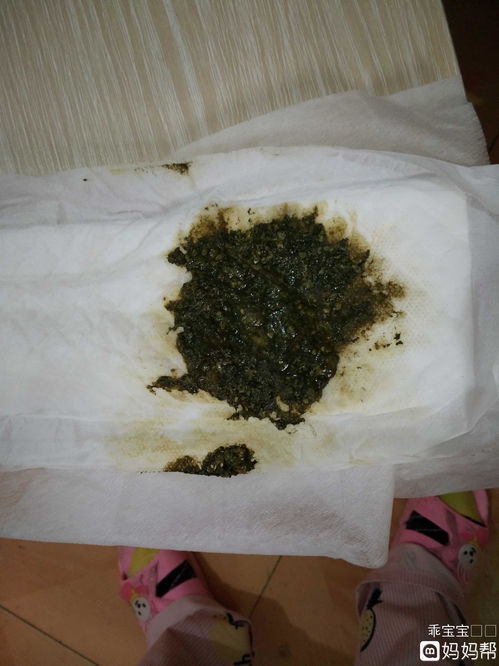 拉屎出鲜血能自愈吗，拉黑屎是什么问题