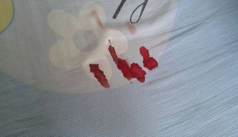 弄在床单上的姨妈血怎么洗，床单上的姨妈血怎么洗掉