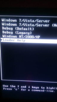 电脑黑屏的处理方法，电脑开机黑屏怎么解决