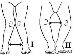 femoral head，femoral artery