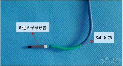 导管子正确手势图片，导管子的危害