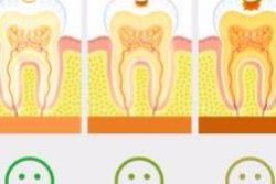 做梦牙齿掉光了是什么预兆女人，做梦牙齿掉 一吐一把
