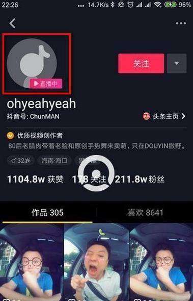 抖音怎么开直播视频教程，抖音怎么开直播教程条件