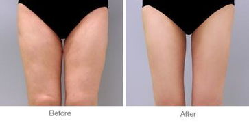 怎样才能让大腿变瘦?，怎样才能让大腿变瘦?学生