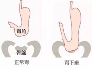 早上吃了饭,中午不吃饭,下午可以做钡餐检查吗?求准确回答。