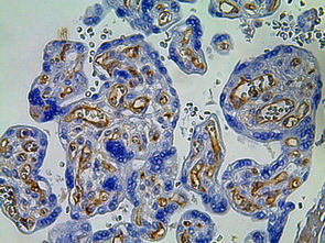 CD31
