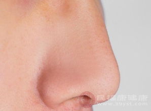 左鼻子出血是什么原因
