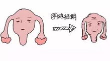 围绝经期
