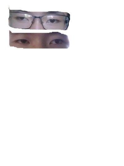 外隐斜
