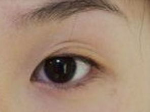 三眼皮
