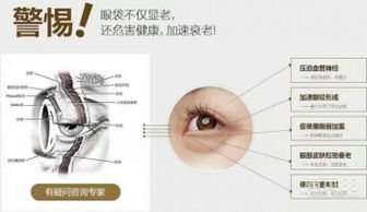 如何迅速去眼袋、黑眼圈?