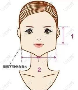 磨骨改脸型需要多少钱?