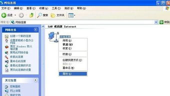 本地ip
