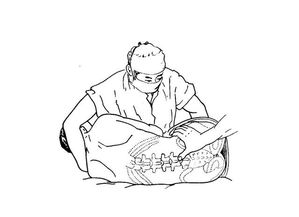 腰穿禁忌症
