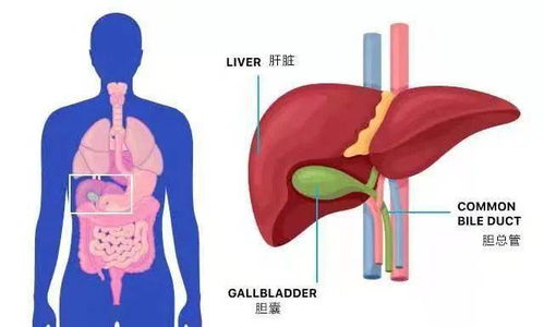 没有胆囊的人 饮食要注意什么