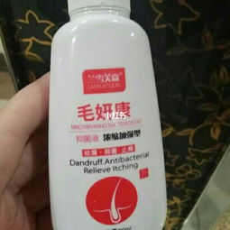 头油多脱 发用什么洗发水?