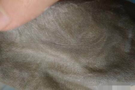 碘伏洒床单上能洗掉吗
