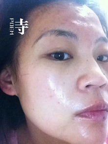 脸上长斑怎么快速消除