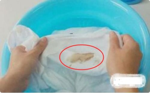 血迹如何快速去除
