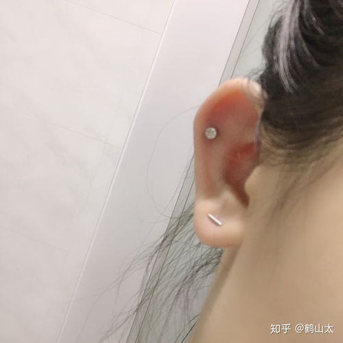 耳洞肿了会自己好吗
