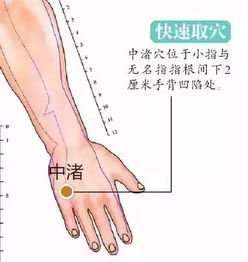 手指不能屈伸是什么病