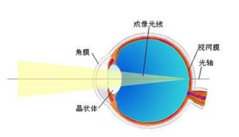 散光和近视的区别

