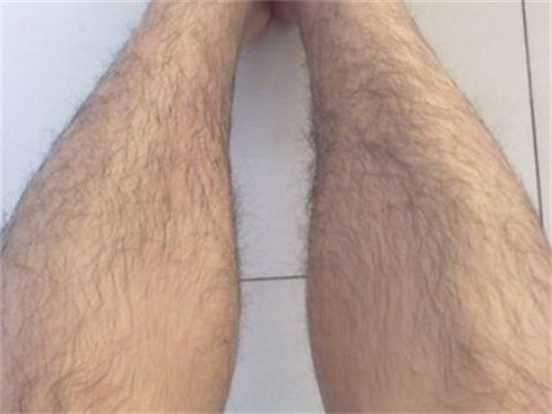 怎样有效去腿毛
