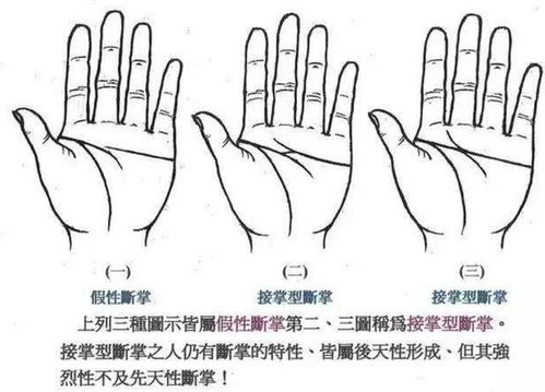 双手断掌纹的男人命运如何?
