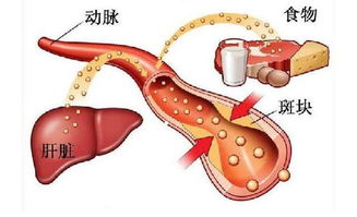胆固醇高有什么危害
