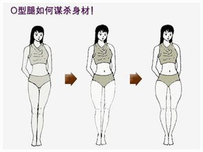 婴儿罗圈腿怎么矫正?