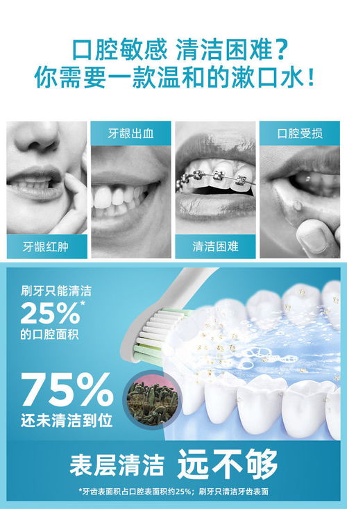 漱口水能去除牙结石吗
