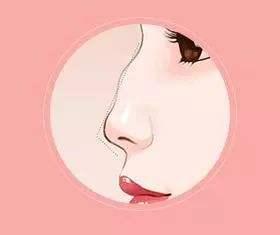 鼻子怎么形容