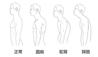 斜方肌是什么样的?
