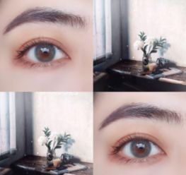 如何判断隐形眼镜的基弧是否合适?