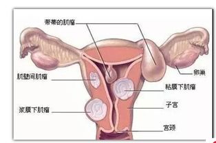 三十岁切除子宫有什么影响，49岁切除子宫有什么影响