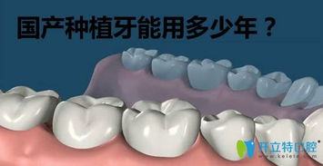 种牙多少钱一颗?