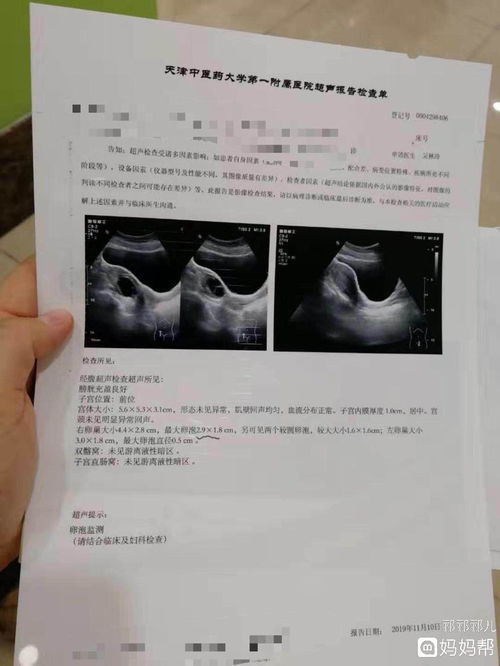 测试排卵试纸怎么看图解，排卵试纸怎么看图解 教程