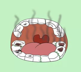 吃完东西嘴发苦怎么回事