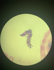 七星高照是什么意思 词语七星高照是什么意思
