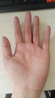 美容师手掌很粗糙手纹很深怎么办