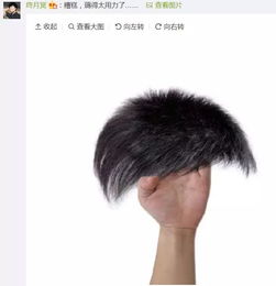 九个月宝宝薅头发是什么意思，薅头发是心理疾病吗