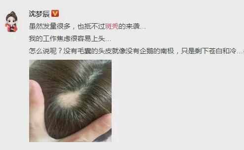 薅别人的头发是啥意思