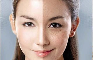 脸上有斑怎么能淡化，脸上的斑自己会淡化么