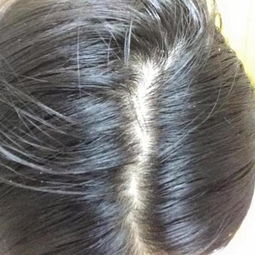 头发洗完后黏黏的没有一点光泽怎么办，头发洗完黏黏的总感觉不干净