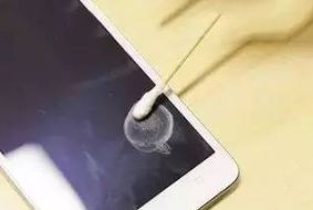 手机听筒的脏东西怎么清理