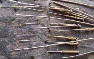 针灸能治疗哪些病?古代针灸用具是几针