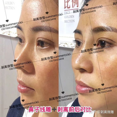 鼻子的作用图片，橘子的作用简笔画